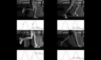 Striking patterns forefoot versus rear foot