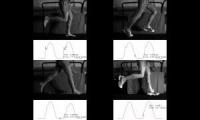 Striking patterns forefoot versus rear foot running