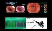 MM endoscopy video sample