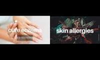 akuo eczema subliminals