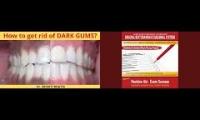 Remove dark pigmentation gums