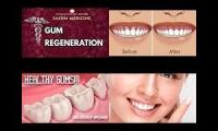 teeth and gums imonlylurking