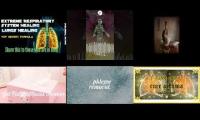 Thumbnail of lungs multi imonlylurking