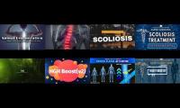 Thumbnail of SCOLIOSIS SPINAL HGH GROW QUADIBLE