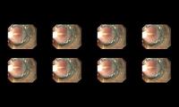 Thumbnail of Perdarahan saluran cerna bagian atas