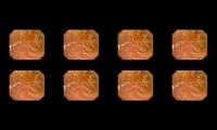 Thumbnail of endoskopi saluran cerna bagian ats
