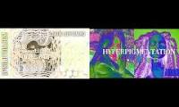 Thumbnail of Xerronskinhyperpigmentationstack