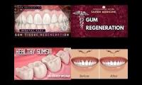 Thumbnail of gum healing imonlylurking