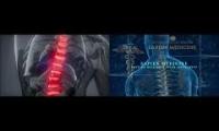 Thumbnail of ** Spinal Perfection **