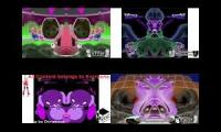 Thumbnail of Blind Major by MusicalNeptunia4126
