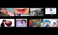 Thumbnail of From In California In Of Canker Sore Determined In Of The Canker Sore In Avalanche From In Part Of