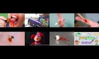 Thumbnail of Nick Jr Flash Games Bleeding In Nick Jr Games In Bleeding Eyeball Pop In Painful Splinter Help In