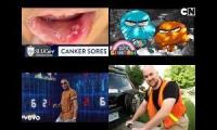 Thumbnail of Canker Sore Determining In Used In Canker Sore Are Fifteen Canker Sore Are Fifteen Canker Sore In On