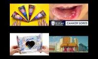 Thumbnail of Canker Sore In Canker Sore From Canker Sore Quick Doctor Canker Sore In Quick From Doctor From In On