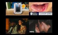 Thumbnail of Canker Sore Quick Doctor From Canker Sore Quick Doctor In Fifteen Canker Sore Quick Doctor In Once