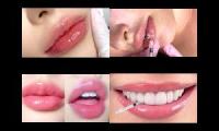 @daintylamb lips, smile, teeth bundle