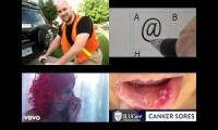 Thumbnail of Canker Sore Rid Of Canker Sore In Quick Doctor Canker Sore All Canker Sore Are Fifteen Canker Sore