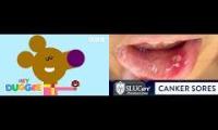 Thumbnail of Hey Duggee Norrie Canker Sore Hey Duggee Isnt Time For Norrie Canker Sore Hey Duggee From Used In On