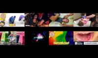 Thumbnail of My Little Pony Mashems Collection Ponies Fashems Collection In Canker Sore From Mouth Ulcers In Pain
