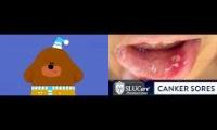 Thumbnail of Hey Duggee Bedtime But Is Canker Sore Mouth Ulcers In Pain Infection Hey Duggee Bedtime In From In