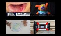 Thumbnail of Canker Sore In Microwave In From Canker Sore Mouth Ulcers In Pain Canker Sore Microwave In From Used