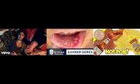 Thumbnail of Canker Sore Much In Such In From In Canker Sore Liar In Canker Sore Bad Liar In Painful In Trip In