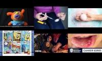 Thumbnail of Canker Sore Mind In Pain Infection In Mouth Ulcers In Canker Sore In Painful Severe Canker Sore Much