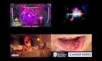 Thumbnail of Dark Screensaver Emerson Canker Sore In Fifteen Mouth Ulcers In Canker Sore In Fifteen Canker Sore