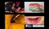 Thumbnail of Echo Tunnel In Canker Sore Tunnel Echo In From Tunnel Echo Random Fifteen Echo Tunnel In From In One
