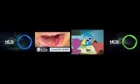 Thumbnail of Canker Sore In Much Sushi Pack Episode In Unveiling Canker Sore Satisfying Canker Sore In Mouth In