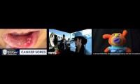 Thumbnail of Canker Sore Couple Annoying Canker Sore In Painful In Canker Sore Fade Real Canker Sore In Much In