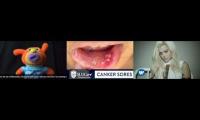 Thumbnail of Canker Sore Determining In Couple Canker Sore In Much Canker Sore Made Special In Canker Sore In One