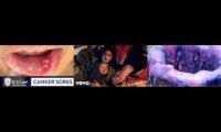 Thumbnail of Canker Sore In Specific Canker Sore Much In Canker Sore Wax Candle Canker Sore In From Couple Much