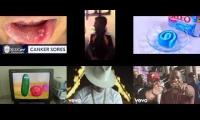 Thumbnail of Veggietales Canker Sore In Mouth Ulcers In From Canker Sore Treatment Funny Canker Sore Goose In For
