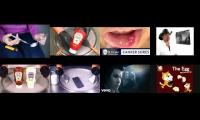 Canker Sore Treatment In Determining Canker Sore In Annoying Goose Canker Sore Patient Canker Sore