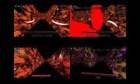 Thumbnail of Chase Universe Burnt Lap 1 Mashup