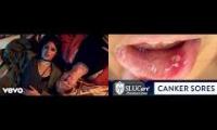Thumbnail of Canker Sore Determined From Canker Sore From Bad Things Canker Sore Quick Mouth Canker Sore From In