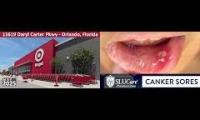 Thumbnail of Target Shopping At Target Store Canker Sore Ulcers Mouth Target Store Because Canker Sore Use Doctor