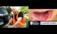 Thumbnail of Canker Sore Determining Canker Sore Sidewalk Cop In Drsmay Videos Sidewalk Cop In Canker Sore In For
